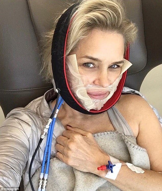 Yolanda Hadid battled the 'invisible illness' for a decade and even wrote a book about her experience called Believe Me.