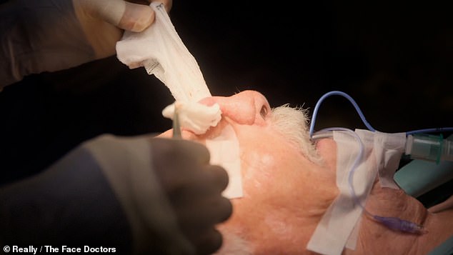 Doctors made incisions in his nose to divide the 'trunk' and create his new nose