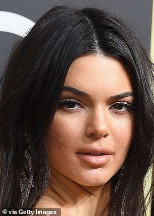 Kendall Jenner is shown above in 2018 with marks on her skin covered with makeup. They are visible on her cheek.