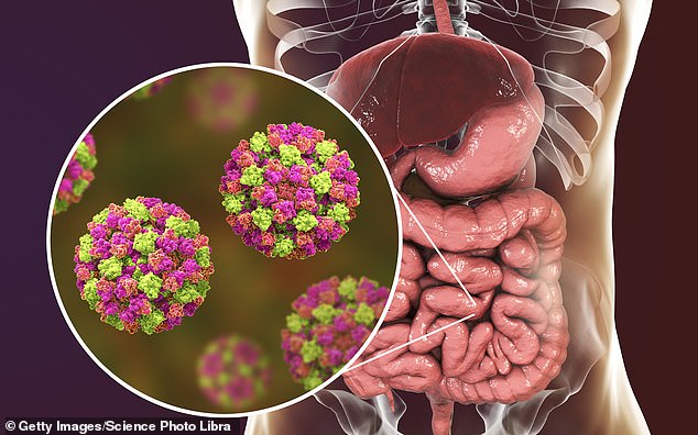 Experts today suggested that Covid restrictions could also be partly to blame for the current surge, as fewer people have been exposed to norovirus than usual since the start of the pandemic. According to their theory, our bodies may be less equipped to fight infection after years with little exposure to them.