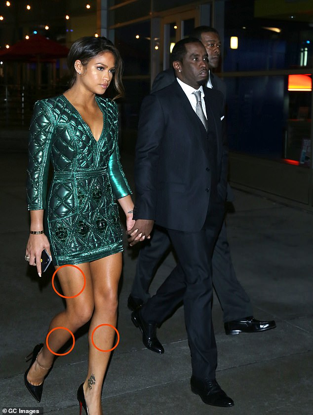 Diddy and Cassie are seen on the red carpet two days after the hotel incident on March 7, 2016. He has visible bruises on his legs.