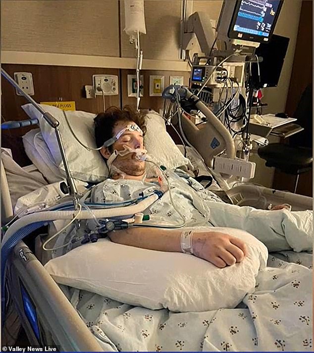 Jackson Allard, 22, suffered from Influenza 4 and double pneumonia due to vaping. He had to undergo a double lung transplant to survive.