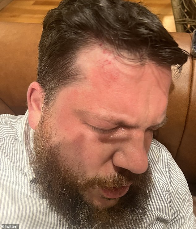 Photos of Volkov's injuries after his home was attacked in March revealed that he suffered a black eye and a red mark on his forehead.