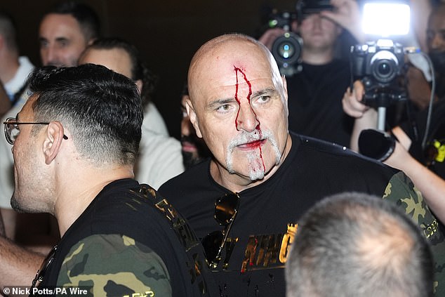 John Fury caused controversy in the build-up when he headbutted a member of Usyks' team.