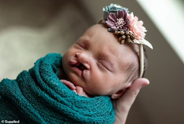 Lisette, from Florida, is known online for her advocacy for children born with the condition that affects her daughter Rosie, now two years old (pictured as a newborn).