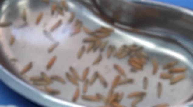 Blurry video footage (pictured) shows countless maggots floating in a small tub of water after they were removed from the woman's mouth.