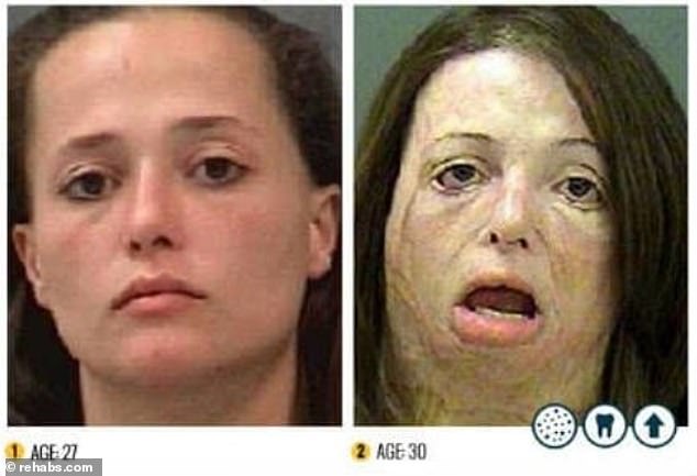 These photographs, taken just three years apart, show how methamphetamine use has changed this woman's appearance in a short space of time.