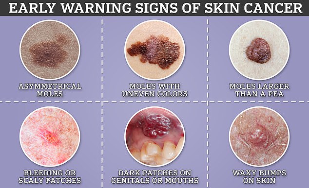 There are three types of skin cancer. Each one can present itself in different ways. These include asymmetrical or abnormal moles, scaly or dark spots, and waxy bumps on the surface of the skin.