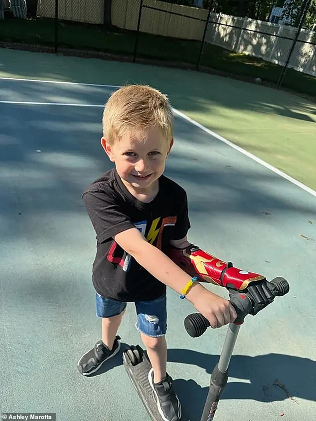 Jordan can now grab his scooter with his new Hero Arm