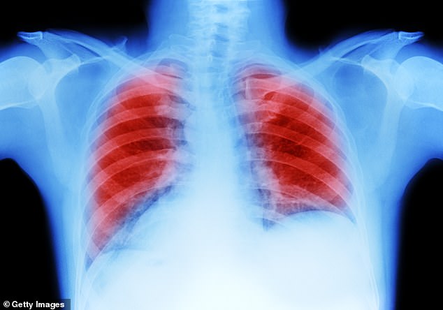 Lung cancer is the third most common cancer in the UK, with 40,000 cases diagnosed annually