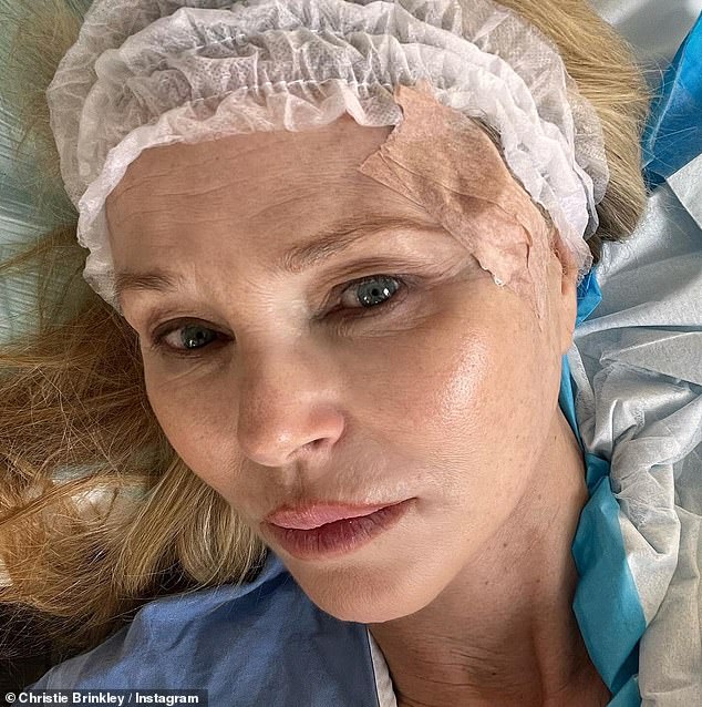 The 70-year-old supermodel first revealed that doctors had found basal cell carcinoma, one of the most common types of skin cancer, on the upper left side of her face last March by sharing a post on her account. from Instagram.