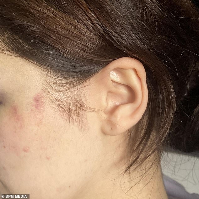 The woman claims the guards sexually assaulted her and forced her to drink an unidentifiable liquid. In this image you can see bruises on her face.