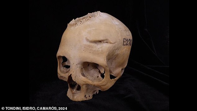 In the study, an international team of researchers examined two human skulls, each thousands of years old.