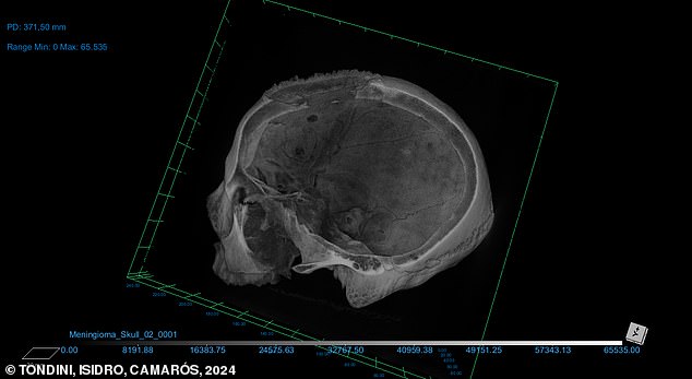 Researchers say studying skeletal remains comes with certain challenges that make definitive statements difficult, especially because the remains are often incomplete and a medical history is not known.