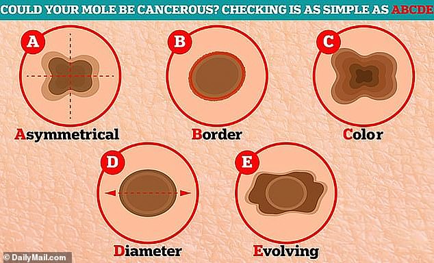 Annual full-body skin checks are recommended, but people can perform regular self-checks at home. When performing the exam, people should be aware of the ABCDEs of skin cancer.