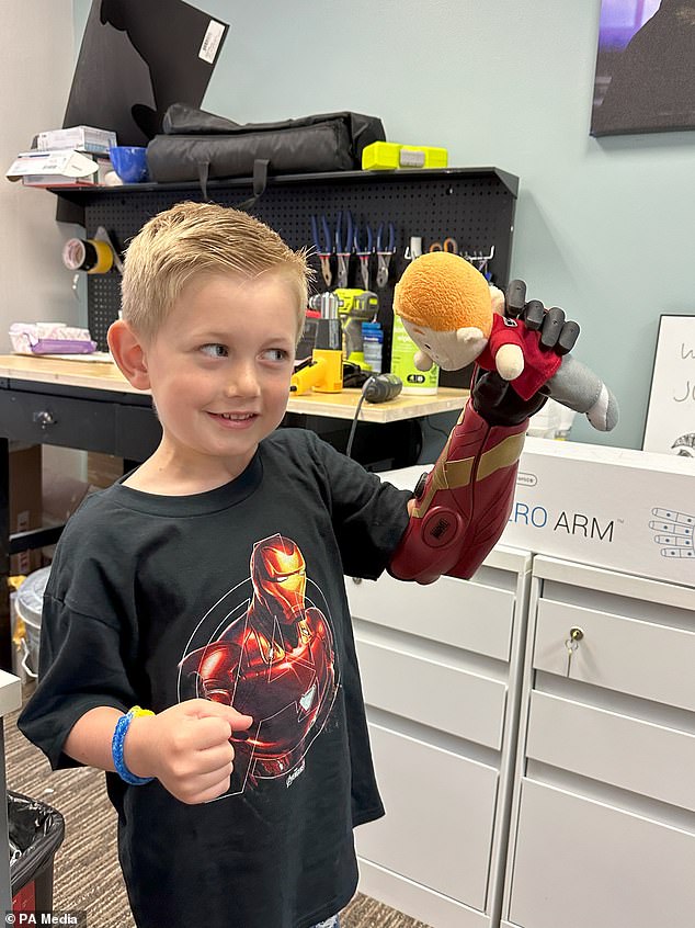 At the age of five, Jordan has become the youngest person in the world to get a bionic Hero Arm.