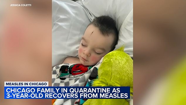 Mother reveals her vaccinated 3 year old son contracted MEASLES in Chicago