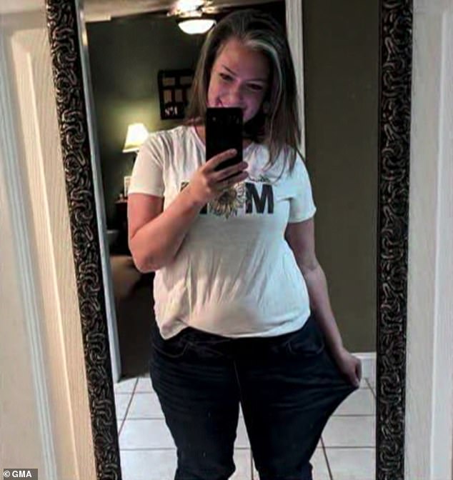 Brooke Nelson was one of 10 people who underwent the minimally invasive procedure and said she lost 26 pounds in six months, bringing her weight to 183 pounds.