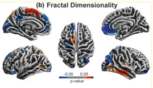 The group that had been asphyxiated showed significant changes in fractal dimensionality (a measure of the complexity of brain structures, which indicates how intricate and detailed the surface of the cortex is) in several brain regions compared to the group that had not been asphyxiated. previously smothered, with increases in some areas and decreases. in others