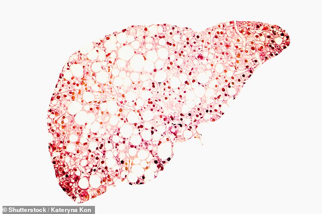 Growing evidence also suggests that patients with NAFLD are at substantial risk of coronary heart disease and irregular heartbeats (file photo)