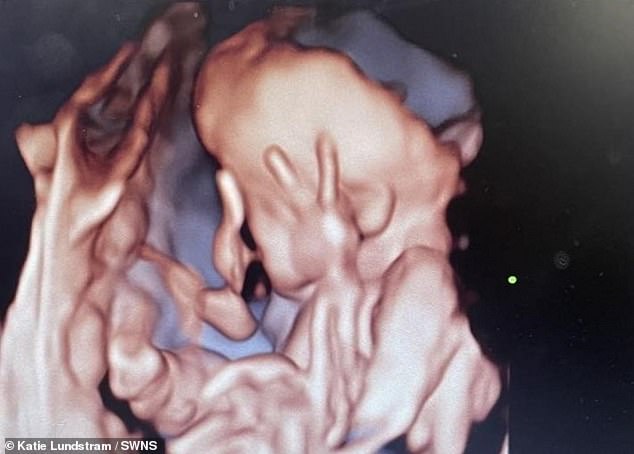 A British mother became hysterical after having an ultrasound and realized her unborn baby was swearing at her (pictured)