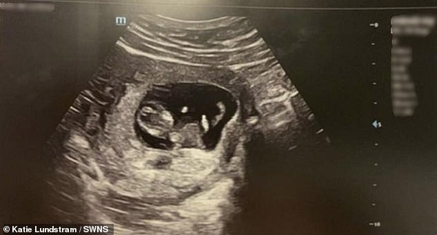 After being told the baby was small, Maddy decided to have a private 25-week scan to put her mind at ease. During the scan, her baby had two fingers raised.