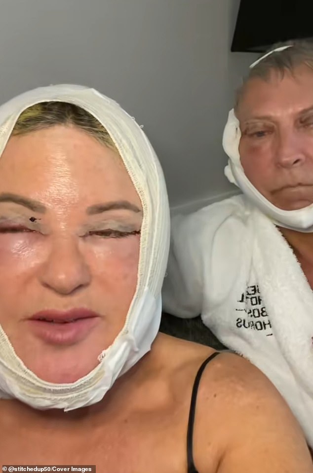 The friends, in the photo, after the operation. The two posted videos before, during and after their trip on TikTok to help other people who are considering traveling abroad for plastic surgery.