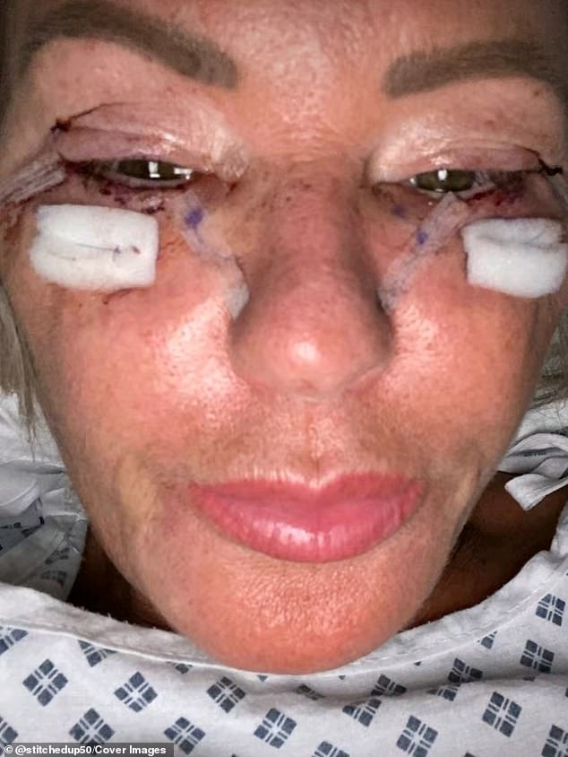 Sharon, 53, showed her followers before, during and after her operations. In the photo after her procedure.