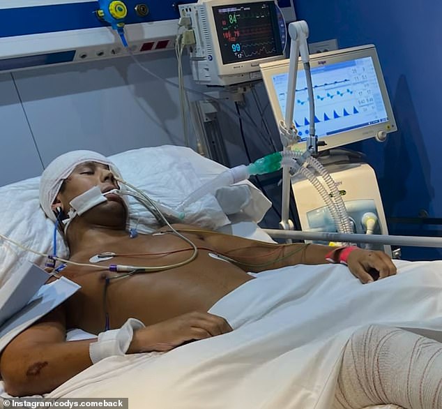 He later learned that his crush had been hit by a car while riding a moped in Ibiza and had suffered significant injuries that left him in a coma.