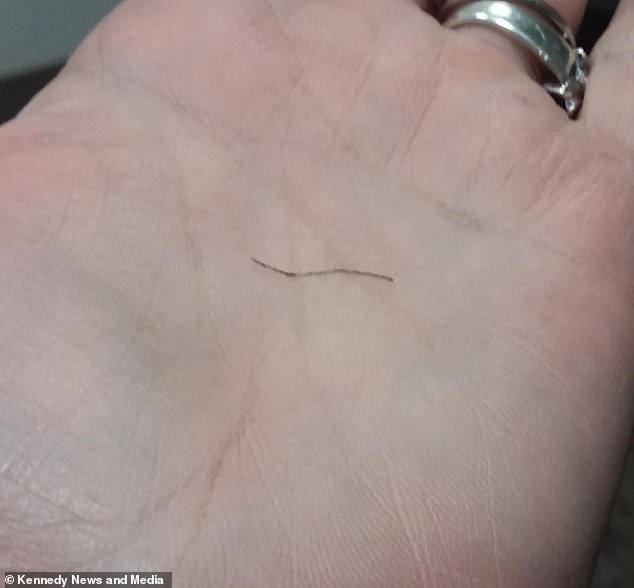 Pictured: The wire bristle that was stuck in Jessica's throat for nine months.