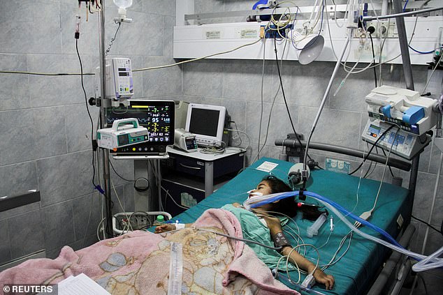 A Palestinian child suffering from malnutrition receives medical attention at the Kamal Adwan hospital in the northern Gaza Strip.