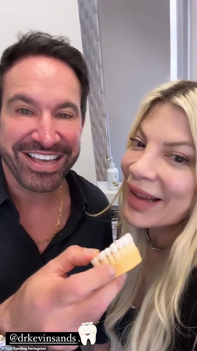 Tori got her veneers just days before her 51st birthday on May 16.