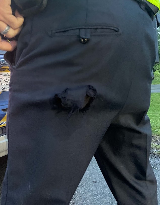 Minor cuts can be seen on the detective's knee and wrist, while his $80 pants, as he claimed in his police citation, are also significantly torn (pictured).