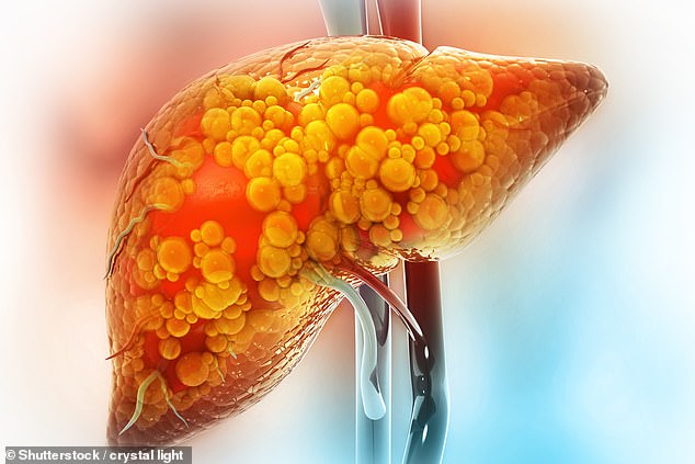 More than half of patients with fatty liver disease, often caused by obesity, saw an improvement in their symptoms after receiving tirzepatide (file image)