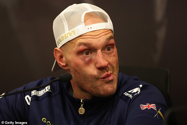 Fury may be struggling to come to terms with his first loss, and fans are worried after seeing him leave a bar over the weekend.