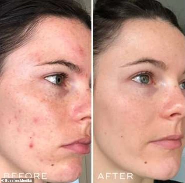 Customers report that they have noticed their skin looking smoother and signs of aging visibly softening after just 12 weeks of using Crystal Retinal Eye Cream and Face Serum.