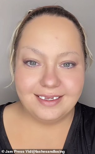 1718310869 753 37 Year Old Woman With No Front Teeth Leaves Internet STUNNING After