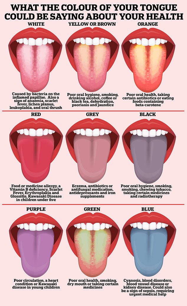 A healthy tongue should be pink, with small bumps (or papillae) all over its surface. However, a variety of other colors could be telltale signs that a person is unwell.