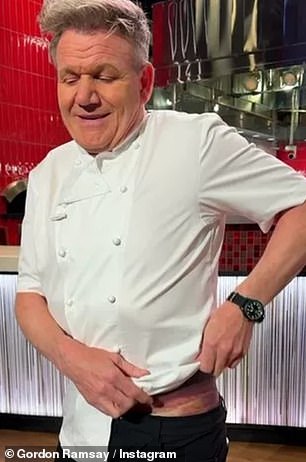 In the video, Gordon lifted his chef's jacket to reveal his injuries, which showed one side of his body covered in black and purple bruises.