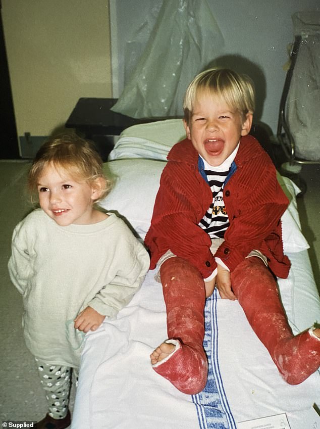 Oscar, with his legs in red casts, appears in the photo with his younger sister Priscilla.