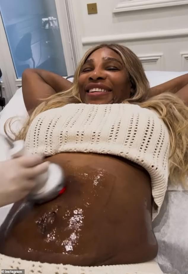 1718747799 423 Serena Williams receives confidence boosting tummy skin tightening treatment less