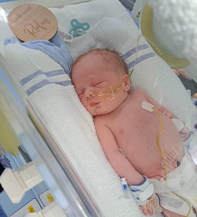 Rufus was diagnosed with cystic fibrosis when he was just a few days old, a genetic disease that causes sticky mucus to build up in the lungs and digestive system.