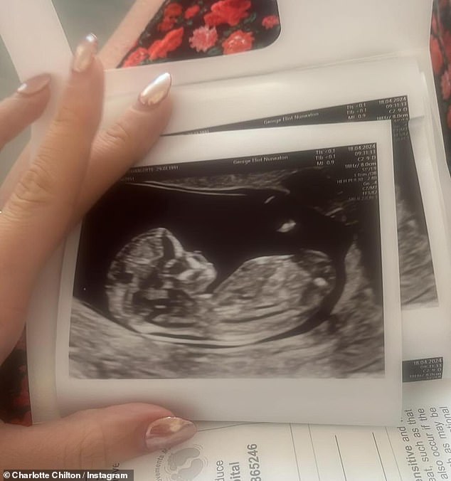 Charlotte wrote: 'After 7 miscarriages in my 20s, a failed insemination and a failed IVF, I was told 'it probably won't happen to you'. Someone decided I deserved a wish by answering'