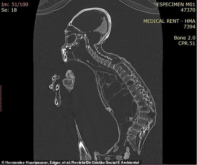 Image analysis also determined that the creature suffered from arthritis in its hands and feet, as well as a damaged spine.