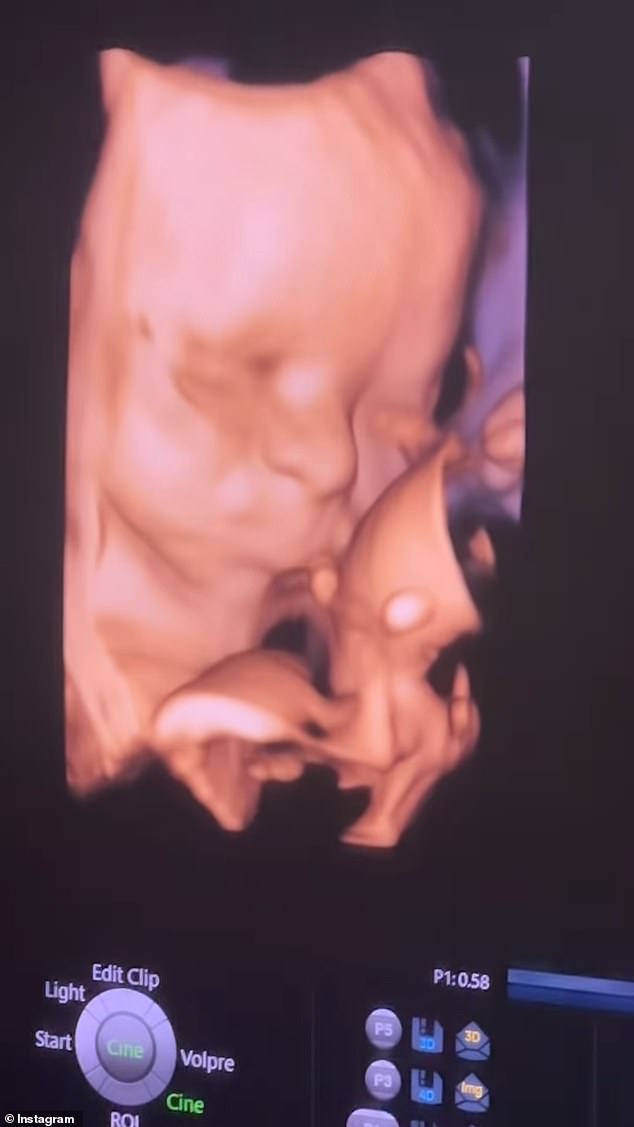 The 33-year-old Vanderpump Rules star posted a video of herself undergoing a 30-week ultrasound on Thursday, three months after confirming her pregnancy.