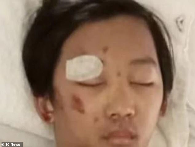 Benjamin spent six days in a coma (pictured), after suffering a fractured skull and brain haemorrhage when he was allegedly dragged 150 meters from a stolen car driven by the group.