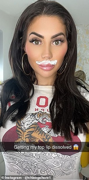 Chloe Ferry has announced she will dissolve her upper lip filler, just two weeks after undergoing breast reduction surgery in Turkey.