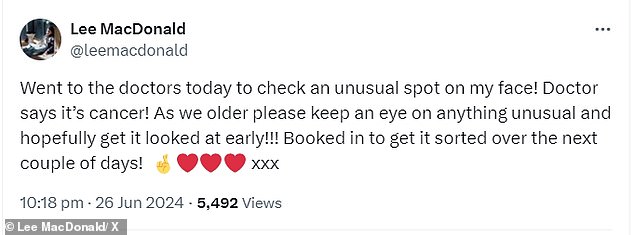 Lee, who played bus driver Terry in the BBC soap in 2019, wrote: 'Went to the doctor today to check an unusual spot on my face! The doctor says it's cancer!