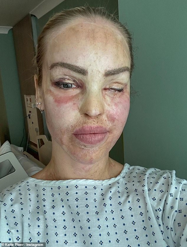 Katie wrote: 'Sadly I won't be on my breakfast show this weekend as I had to undergo an unexpected medical procedure. Everything is fine' (pictured in 2023)