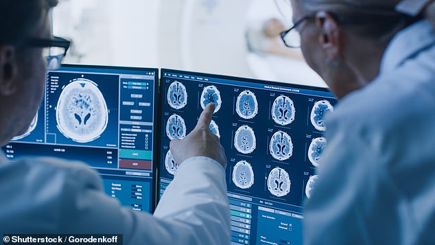 The purpose of the clinical trial that Sarah was invited to try was to see if the proton particles were as effective at shrinking the tumor as radiotherapy, while at the same time being less harmful to the surrounding healthy brain tissue (file image)